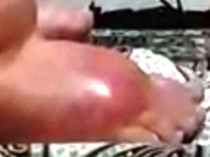 Zayıflamak isterken ölümden döndü! G4