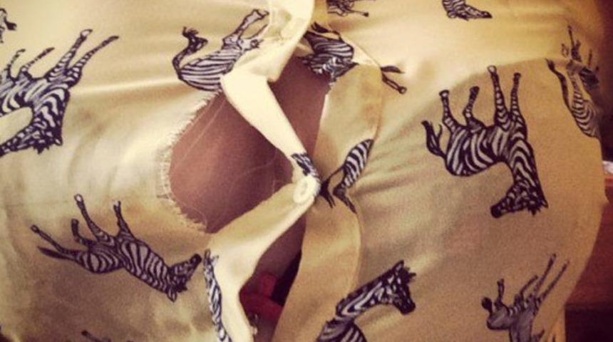 Büyük göğüsler kadınlarda birçok probleme sebep oluyor 