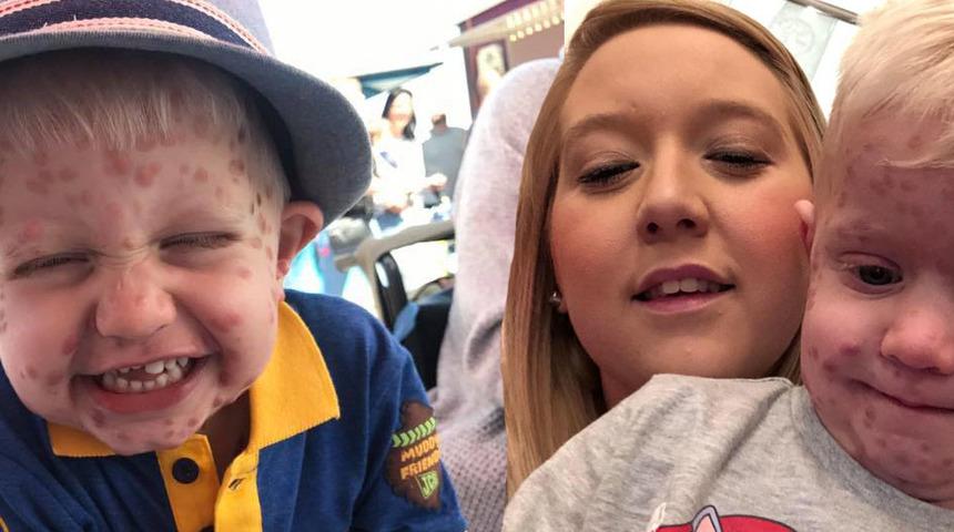 Su &ccedil;i&ccedil;eği &ccedil;ıkarıyor sandılar doktora gidince ger&ccedil;ek ortaya &ccedil;ıktı