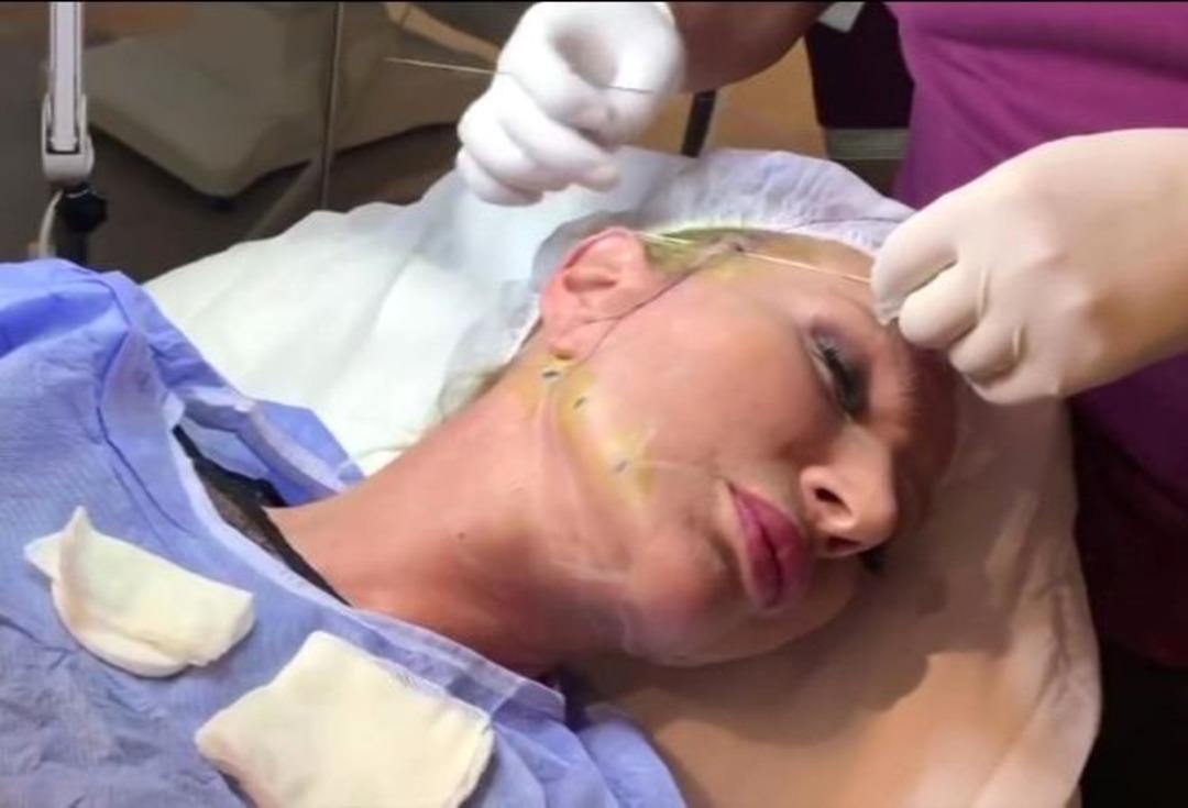 Seda Sayan y&uuml;z&uuml;n&uuml; gerdirdiği anları paylaştı