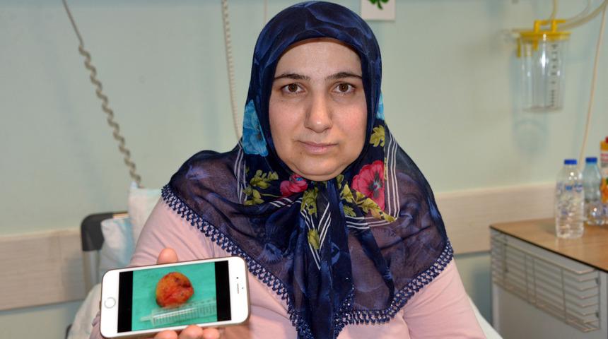 Kalbinden 6 santimetre &ccedil;apında kitle &ccedil;ıkarıldı  