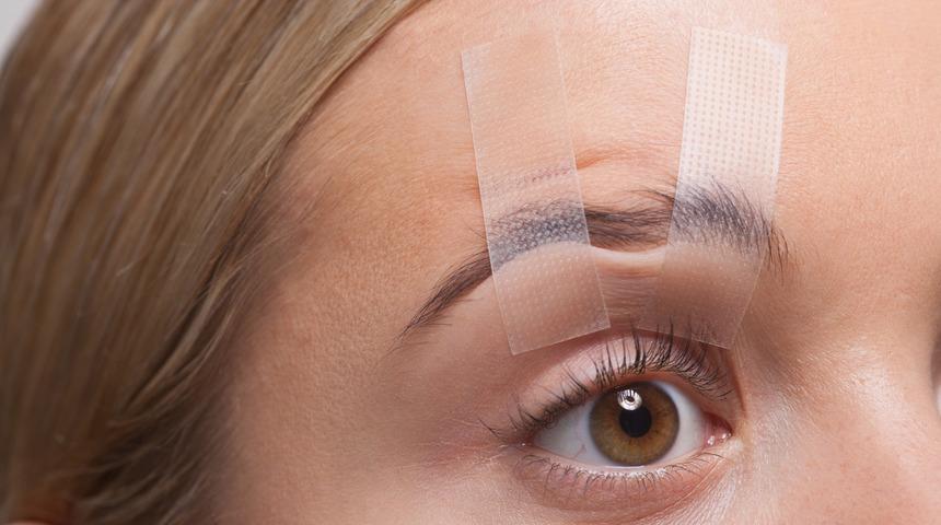 Üst göz kapağı estetiği nedir, nasıl yapılır?