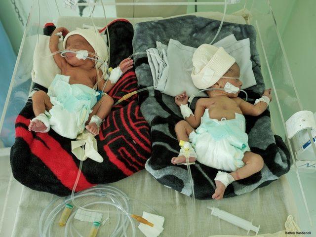 Yemen’de anne ve çocuklar sağlık hizmetlerine ulaşamadan ölüme terk ediliyor