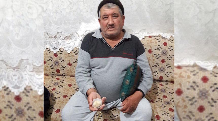 Doktorlar bile hayrete düştü! Mesanesinden 300 gram taş çıktı