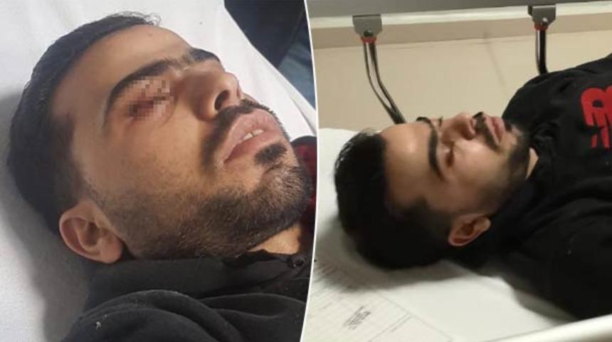 Gözüne saplanan çivi iki saat süren operasyonla çıkarıldı