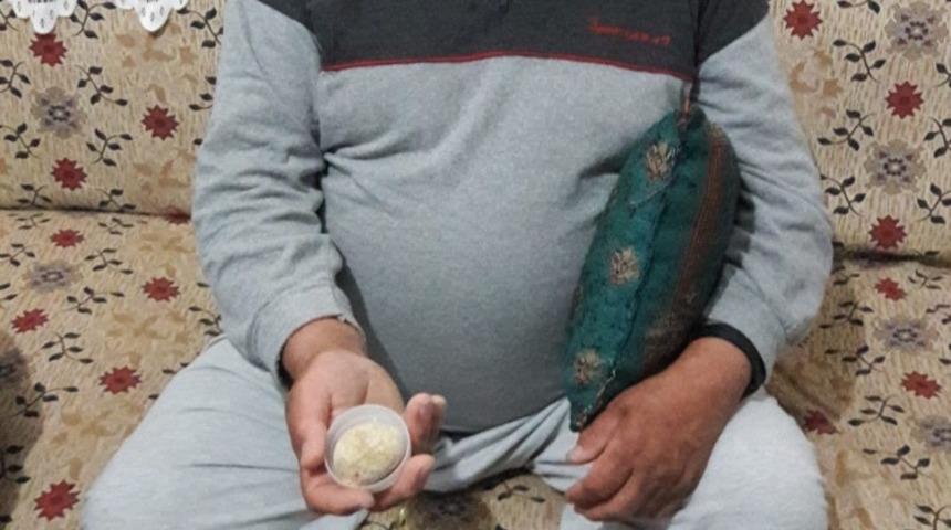 Mesanesinden 300 gram ağırlığında taş çıktı