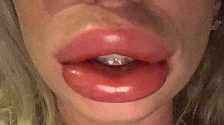  Ucuz diye yaptırdı, &ouml;l&uuml;m&uuml;n kıyısından d&ouml;nd&uuml;!