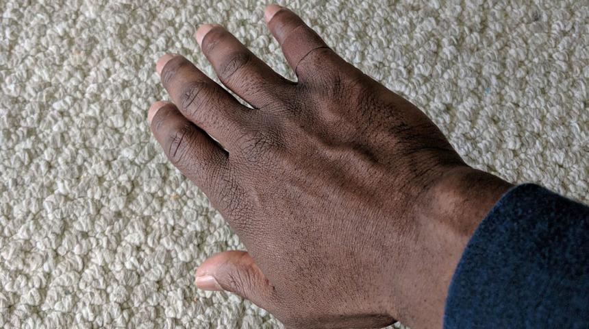 Tenine uygun yara bandı bulan adam sosyal medyayı salladı