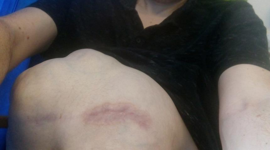 5 yılda bu hale geldi! Hamile gibi görünüyor