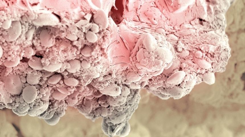 Nimetle Oyun Olmaz: Mikroskop Altında Yedikleriniz Nasıl G&ouml;r&uuml;n&uuml;yor?