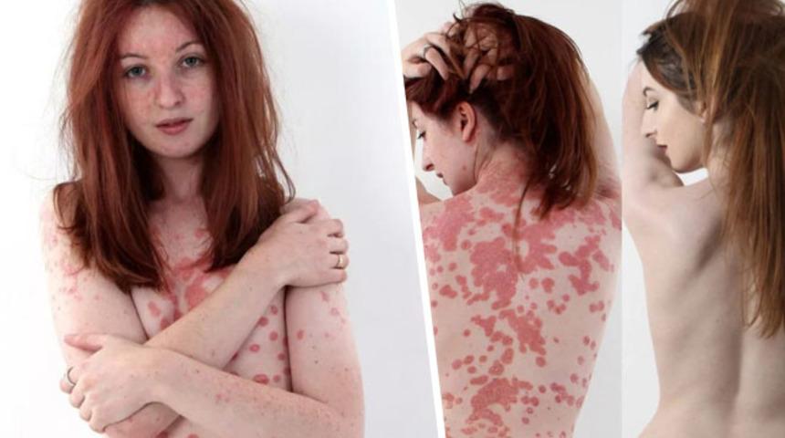 Başta kendini öldürmeyi bile düşündü! Ama şimdi... 