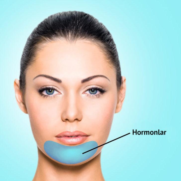 Pek umursamıyoruz ama sivilceler ayrı ayrı hastalık habercisi! G2