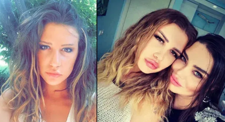 Kısmetse Olur'la tanınan Melis Buse Betkayan'u görenler tanıyamadı  G5