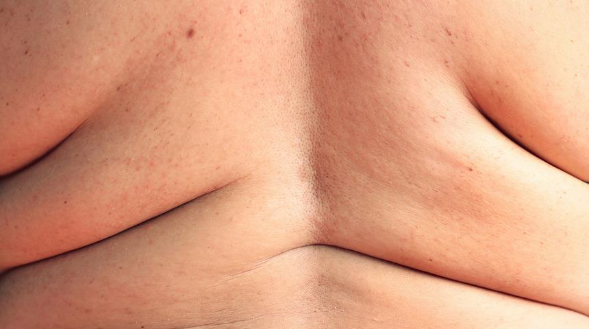 Beslenme Uzmanı Koçak, ‘’Diyetler parmak izi gibidir, herkes her diyeti yapamaz’’