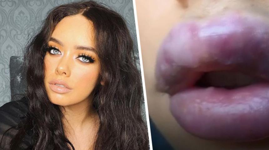 Görünce gözlerine inanamadı! Dudakları bir anda morardı! 