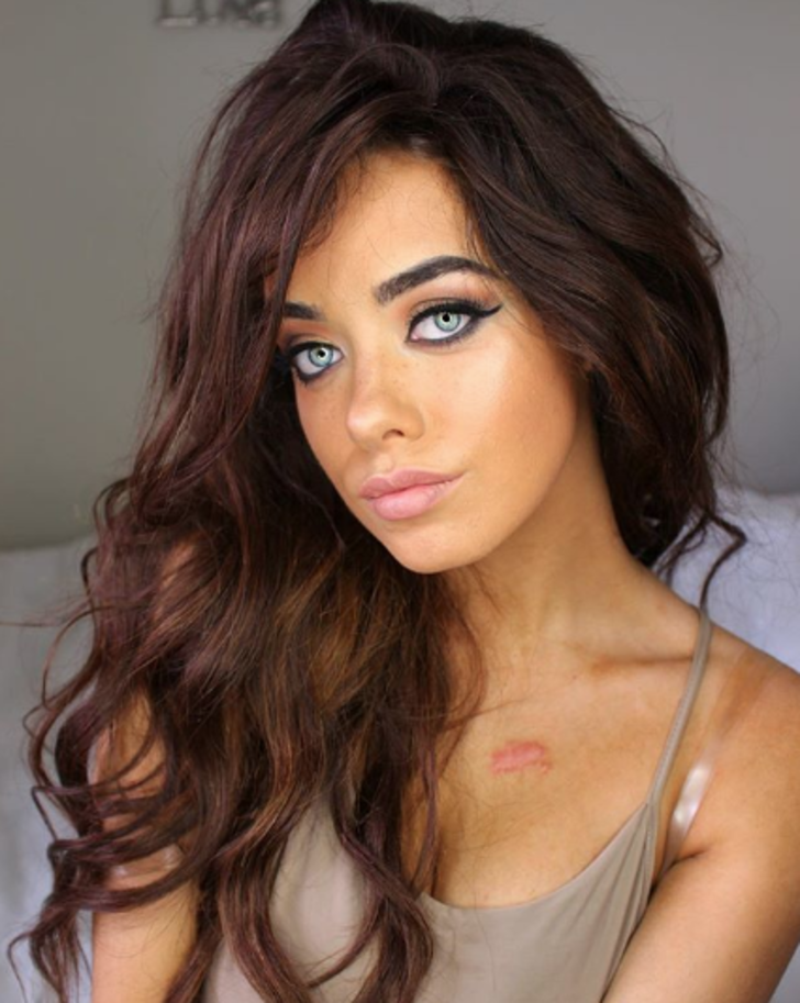 Korkunç! Ünlü yıldızın dudağı ölüyor G4