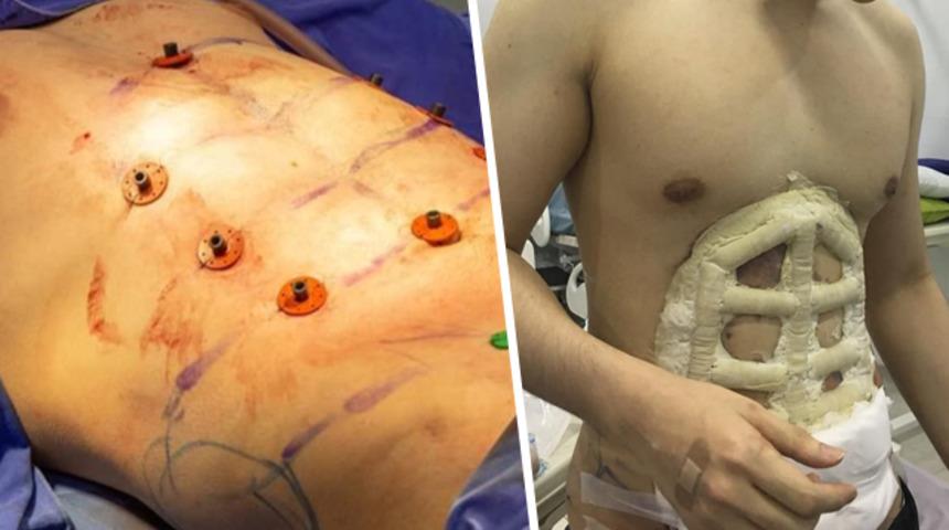 Erkeklerde yeni moda: Ameliyatla baklava yaptırıyor!