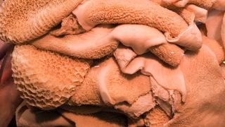 Zararlı sanıyorduk! Sağlığımız için öyle bir faydası çıktı ki...