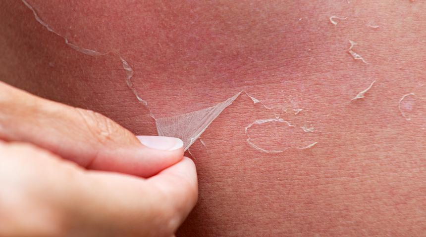 Uzmanlar uyarıyor! '&Ouml;l&uuml; deriden kurtuldum sanıyorsunuz' ama... 