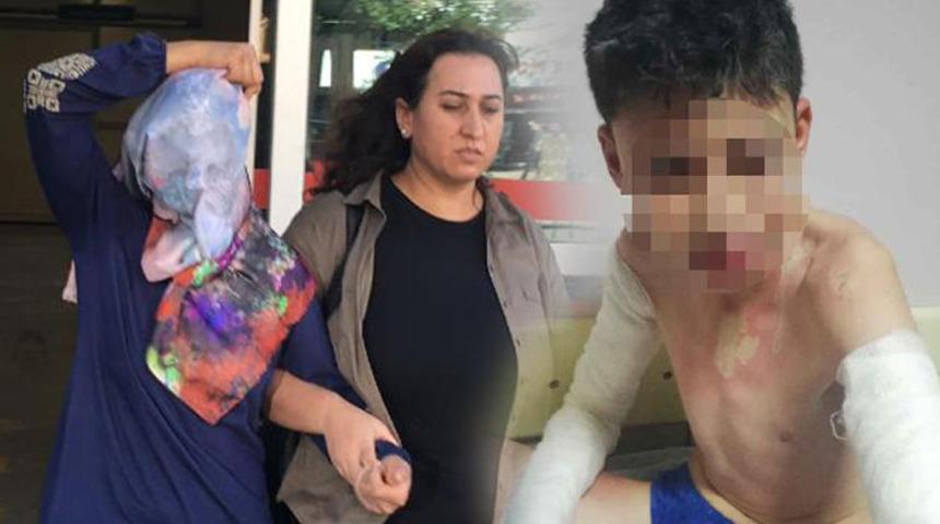 Konya'da komşusuna ve 3 çocuğa kezzapla saldıran kadının savunması pes dedirtti