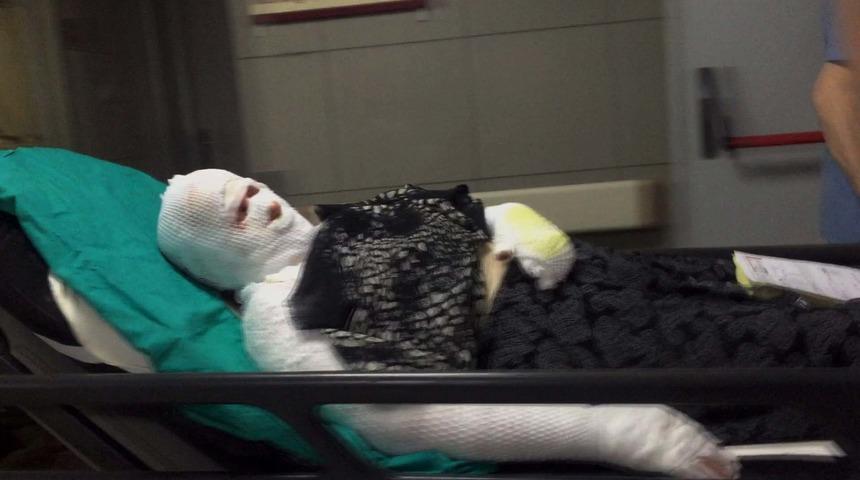 Kulak kıllarını temizlediği fel&ccedil;li eşini ve kendisini yaktı