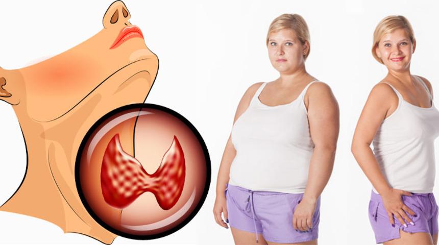 Tiroidi Daha Az &Ccedil;alışan Kişiler Kilo Vermek İ&ccedil;in Ne Yapmalı?