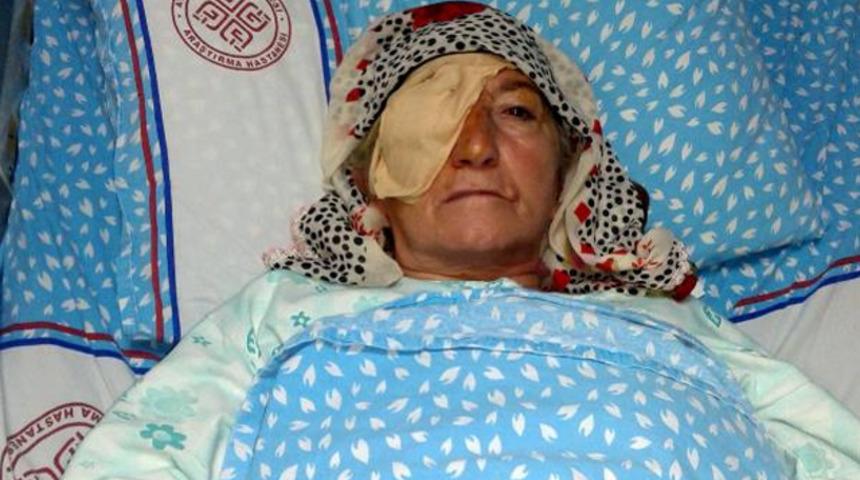 Katarakt ameliyatları sonrası 3 kadın görme yetisini kaybetti! 570 bin liralık dava açıldı