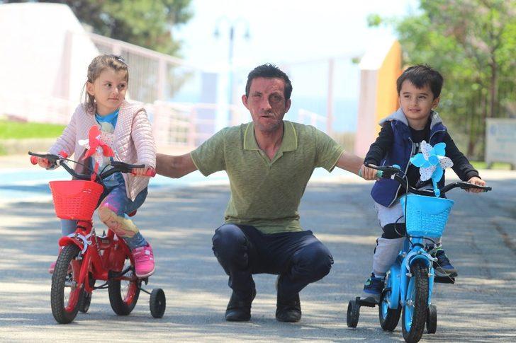 7,5 yıl önce yüz nakli olmuştu! İşte son hali G1