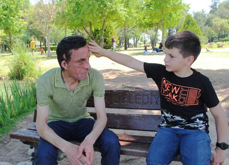 7,5 yıl önce yüz nakli olmuştu! İşte son hali G3