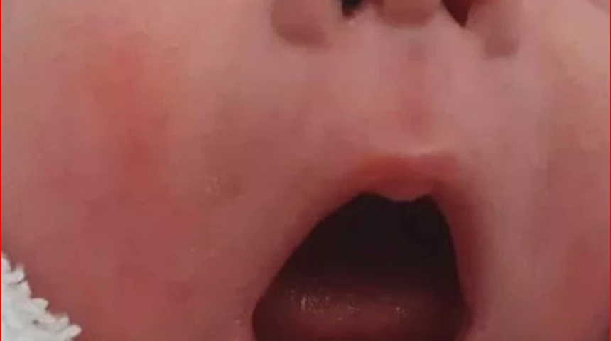 İki binde bir! Dişleriyle doğan bebek şaşkına çevirdi