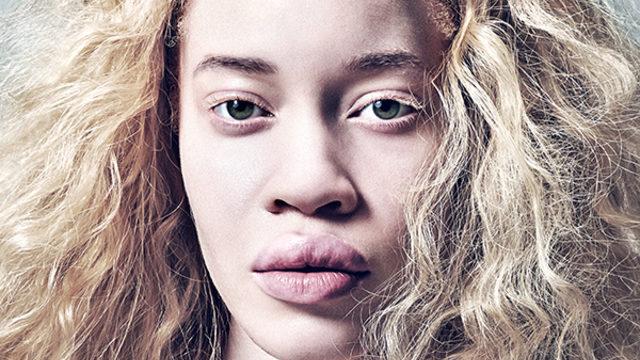 Güzellik tabularını yıkan Afro-Amerikan albino model Diandra Forrest