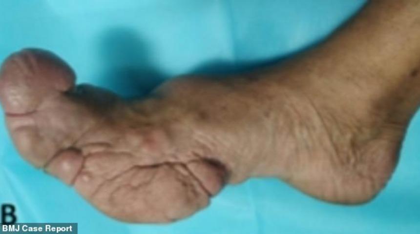 Doktorlar inanamadı! Olması gerekenin iki katı