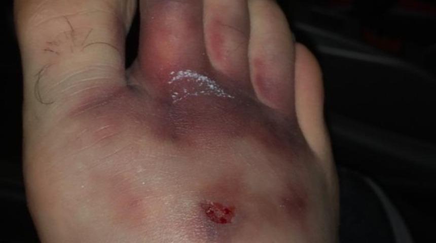 Tiago Lopes ayağının durumunu paylaştı