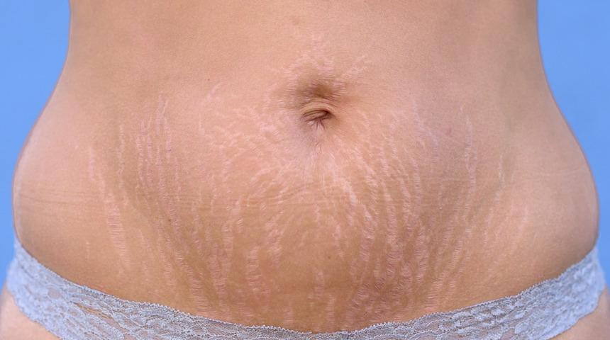 M&uuml;kemmel g&ouml;r&uuml;n&uuml;ml&uuml; bir v&uuml;cut i&ccedil;in &ouml;neriler