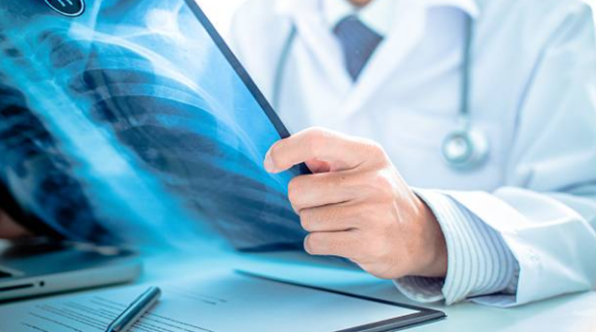 Akciğere yayılım yapmış tümörlerde cerrahi mümkün mü?