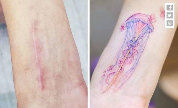 Yara izleri olanlar dikkat! Öyle bir şey denedi ki... G1