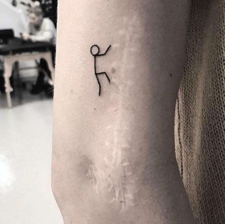 Yara izleri olanlar dikkat! Öyle bir şey denedi ki... G4