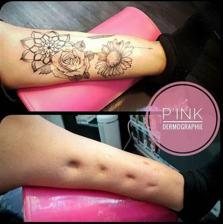 Yara izleri olanlar dikkat! Öyle bir şey denedi ki... G5