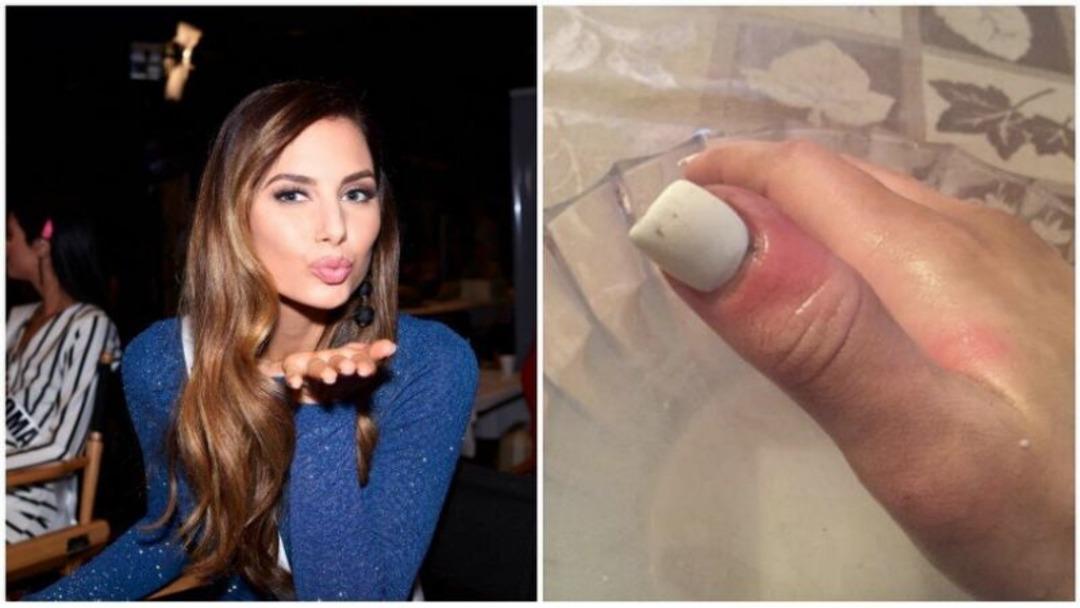 Kabuk zannedip kopardı! Meğer durum daha korkun&ccedil;muş!