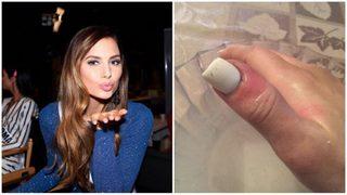 Kabuk zannedip kopardı! Meğer durum daha korkunçmuş!