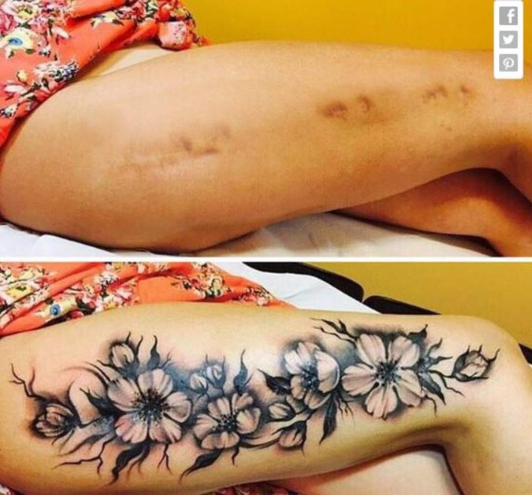 Yara izleri olanlar dikkat! &Ouml;yle bir şey denedi ki...