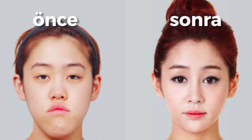 Bu Yarışmanın &Ouml;d&uuml;l&uuml; Estetik Ameliyatla Başka Biri Olmak!