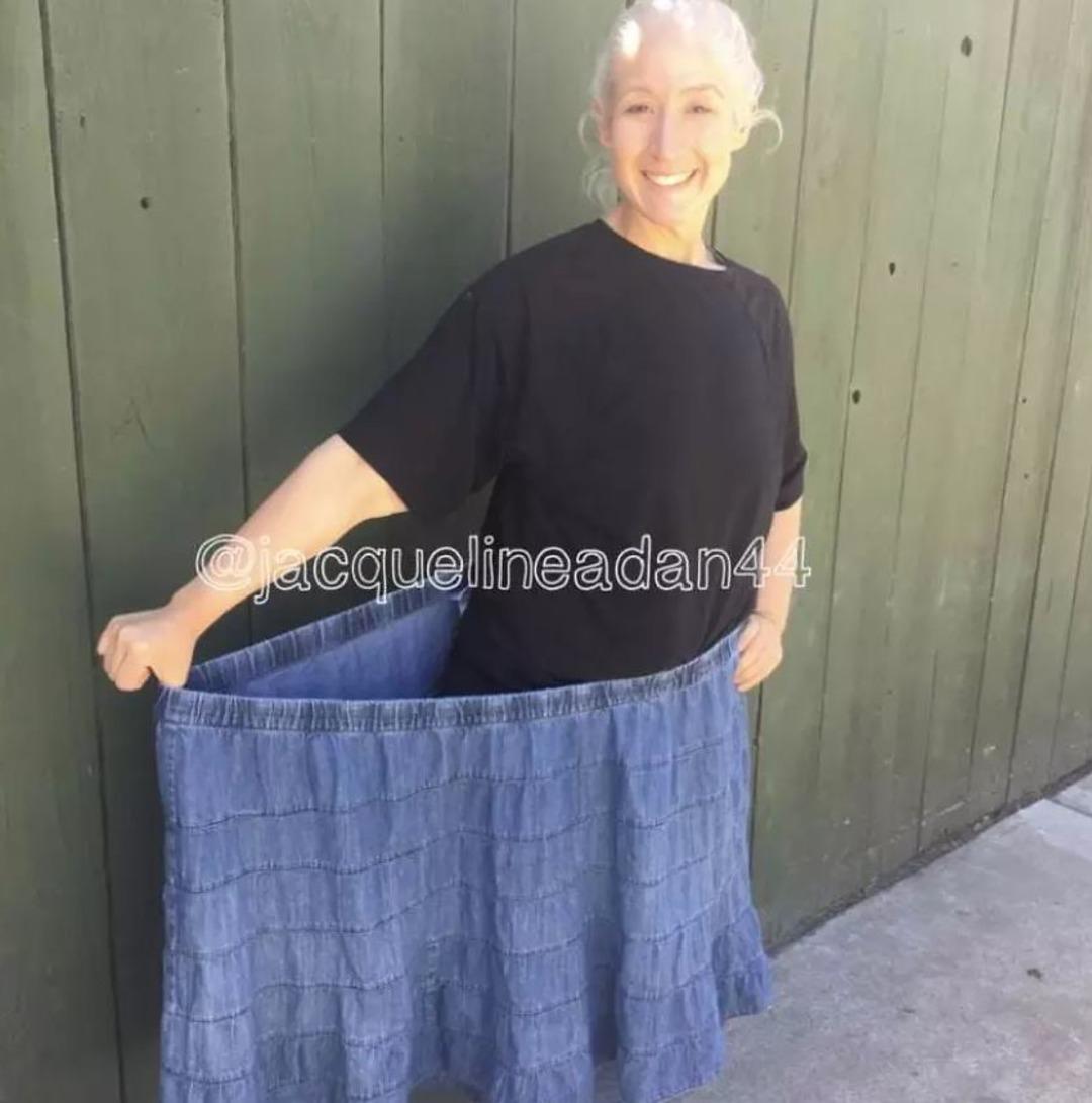 158 kilo veren gen&ccedil; kız bacaklarıyla alay edenlere tarihi ayar verdi!