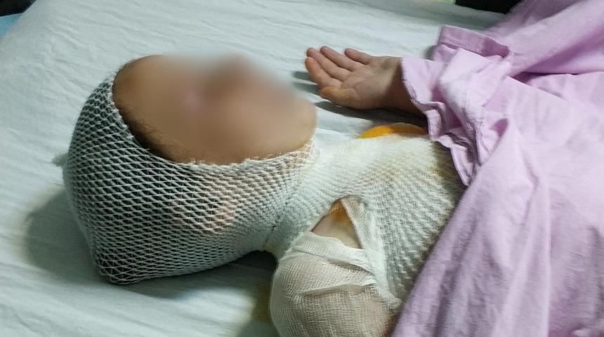 Kaynatılırken taşan s&uuml;t &ccedil;ocuğu hastanelik etti