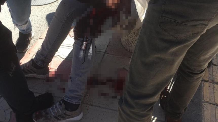 Kız meselesi kanlı bitti: 1 yaralı