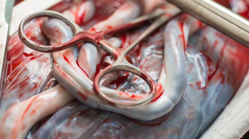 Uzmanlar uyarıyor:  Plasenta yemenin yararı yok zarar bile verebilir!