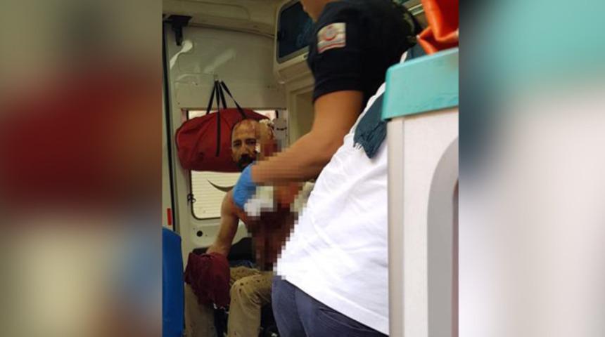 Çay ocağı işletmecisini başından tornavidayla yaraladılar