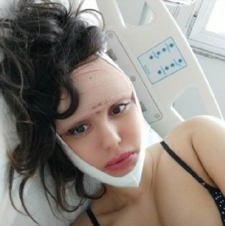 10 yılda 22 kez estetik ameliyat oldu! G2