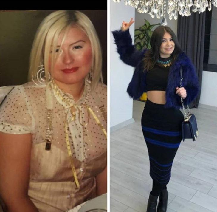 10 yılda 22 kez estetik ameliyat oldu! G3