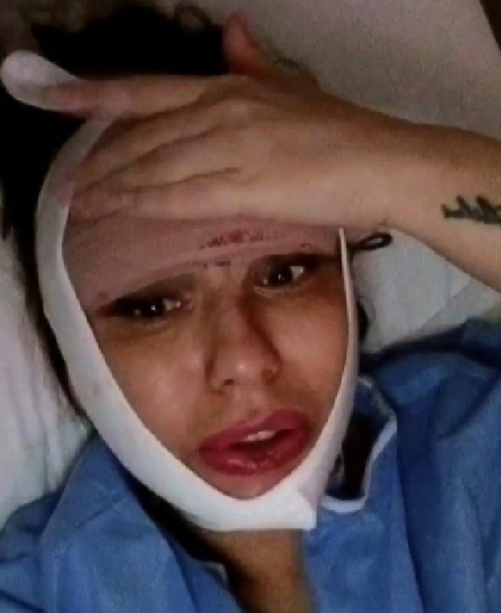 10 yılda 22 kez estetik ameliyat oldu! G4